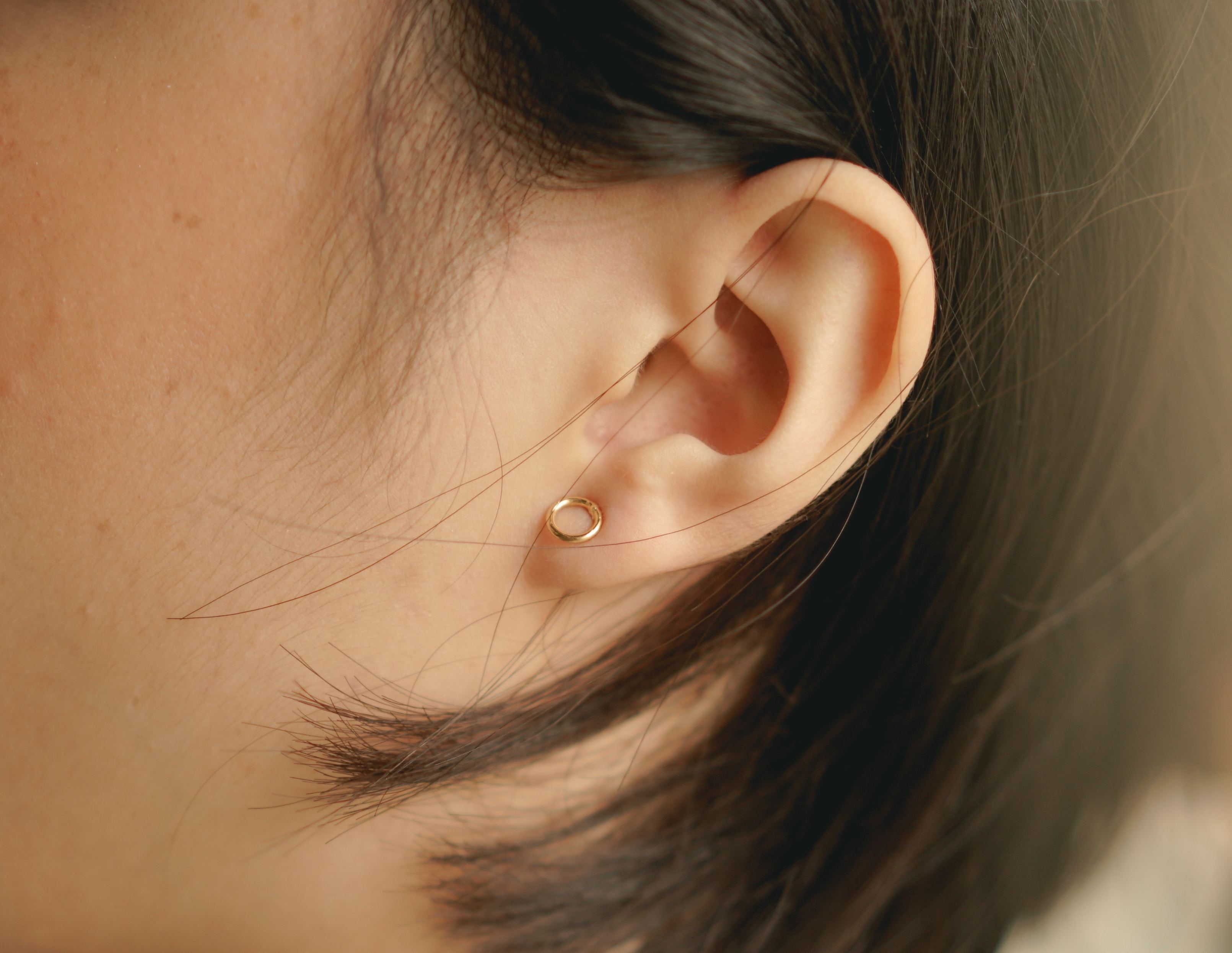 Tinnitus: What Is It?